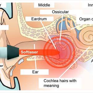 Tinnitus Therapies 