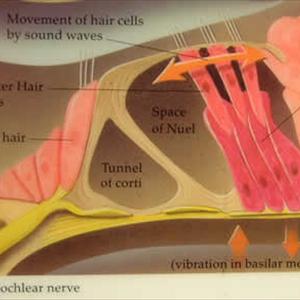 Throbbing Tinnitus - Ringing Ears Loud Music - Is There Ringing In Your Ears?